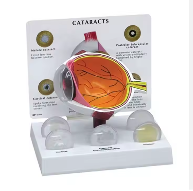 Educational Advance Eye Enlargement Anatomical 6 Parts 3D Plastic Cataracts Medical Science Human Eye Model for Teaching