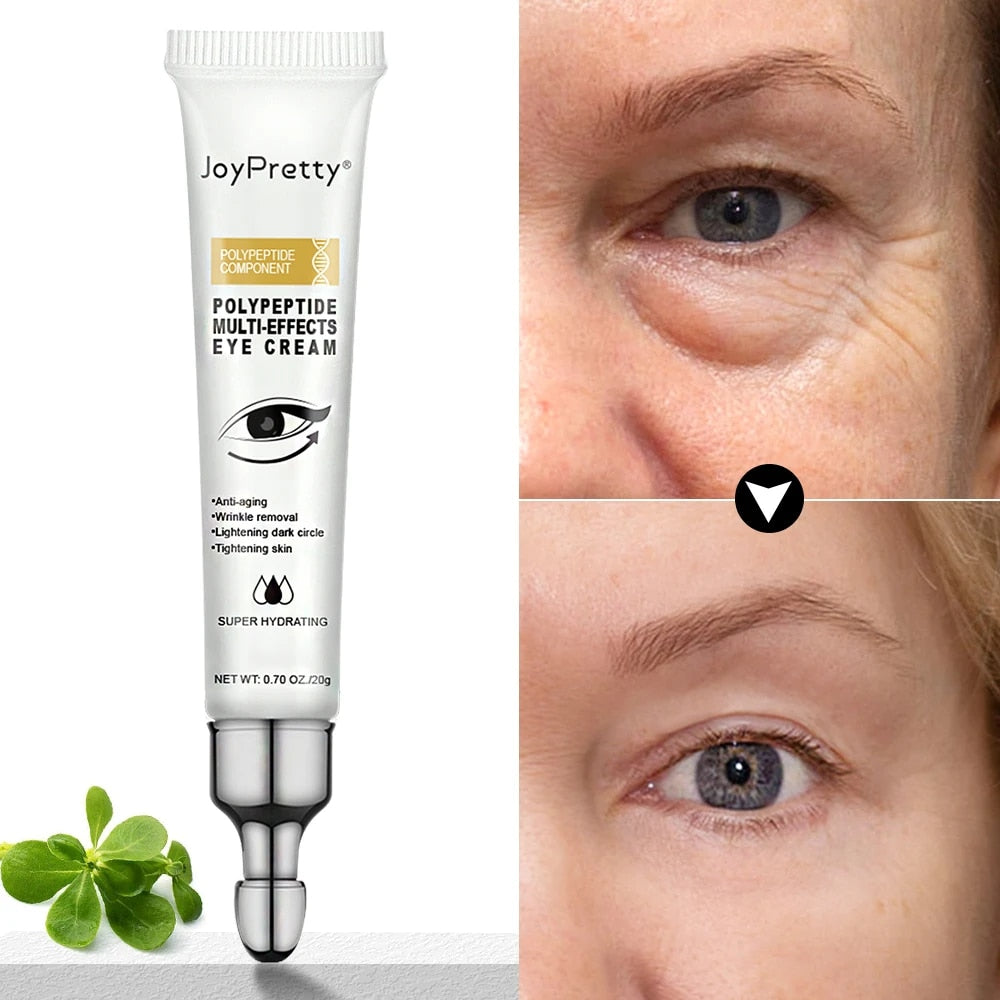 JoyPretty Eye Bags Eye Cream Multi-effects Wrinkle Removal Anti Aging Tightening Puffiness Treatment Under Eye Skin Care Beauty